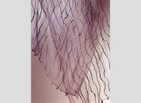 ビットウィーンクロス